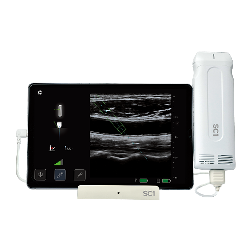 SC1 - Handheld Navigation Ultrasound Device