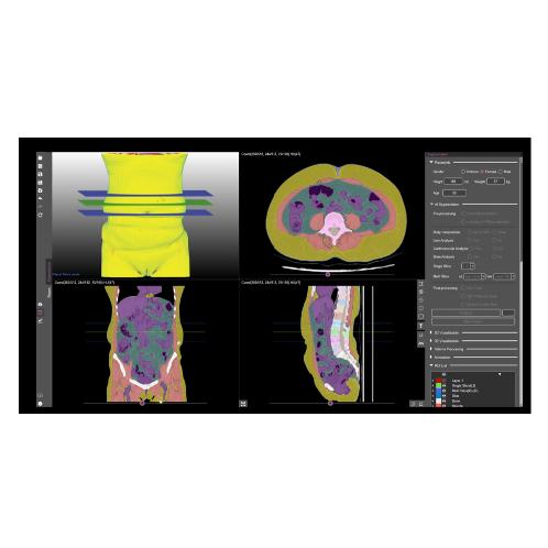 MEDICAL IP DeepCatch